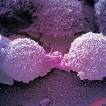 Cancer cells programmed back to normal by US scientists