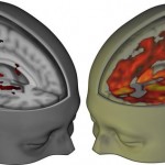 LSD’s impact on the brain revealed in groundbreaking images