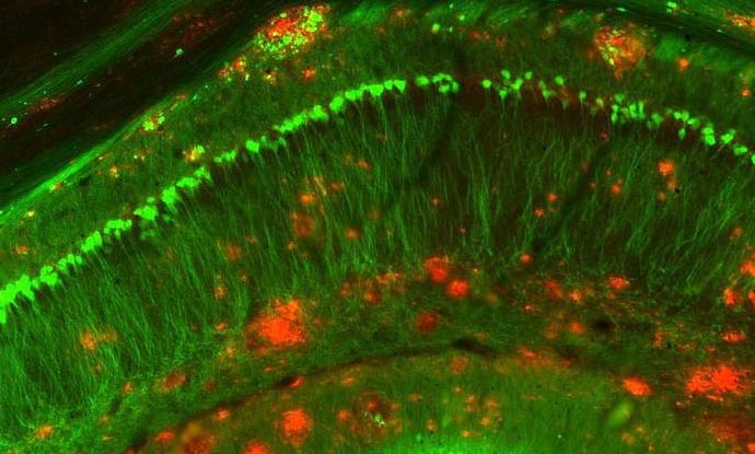 New protein injection reverses Alzheimer’s symptoms in mice in just one week 