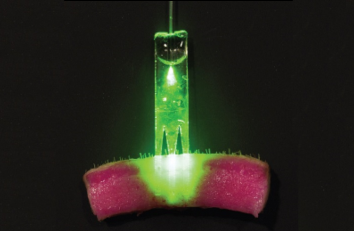 Someday, Suturing a Wound Will Involve Lasers
