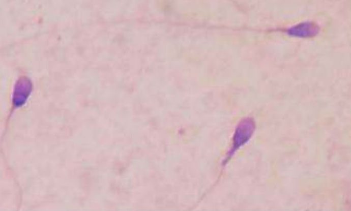 Scientists have just made sperm out of human skin cells 