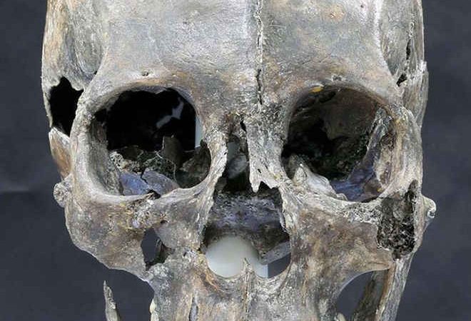 Bizarre, Long-Headed Woman from Ancient Kingdom Revealed