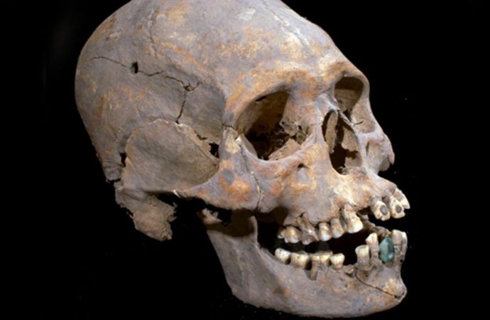 1,600-Year-Old Elongated Skull with Stone-Encrusted Teeth Found in Mexico Ruins