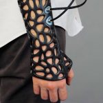 Can this 3-D Printed Cast Really Heal Bones Faster?