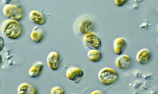 Genetically modified algae could soon show up in food, fuel, and pharmaceuticals