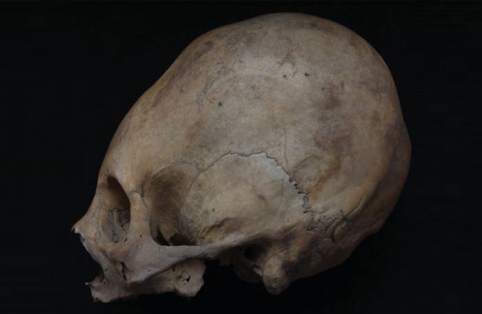 Elongated heads were a mark of elite status in an ancient Peruvian society