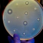 The Clock Is Ticking on Superbugs