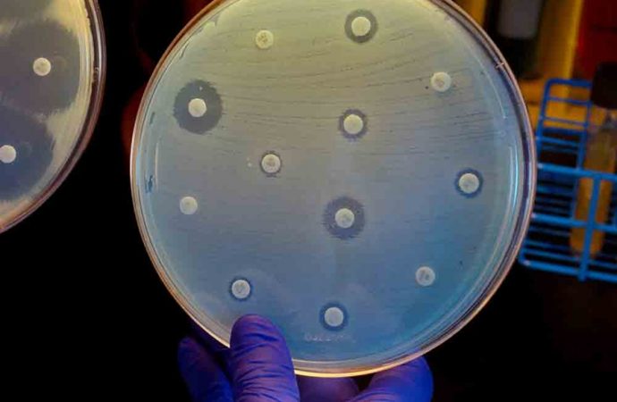 The Clock Is Ticking on Superbugs