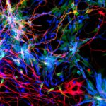 Trio of genes supercharged human brain evolution