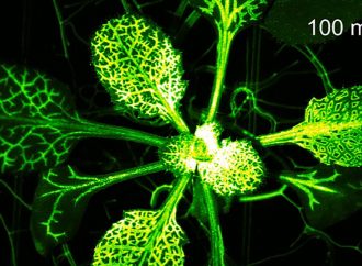 Triz Remedios Plays Music with Plants. Introduction by Bobby Curtola