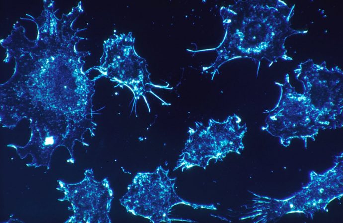 A cure for cancer? Israeli scientists say they think they found one