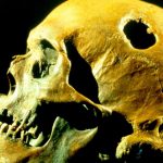 Why our ancestors drilled holes in each other’s skulls