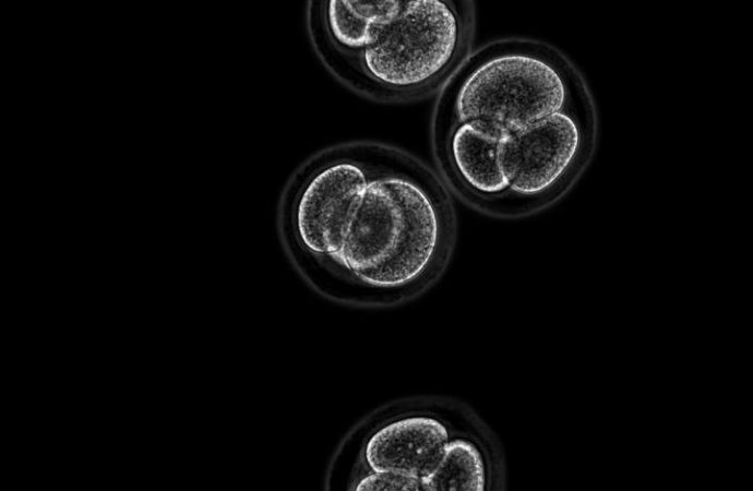 Embryo stem cells created from skin cells