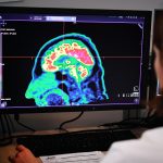 Aggressive Brain Cancer Treatment: Ohio Students’ Research Shows Promise
