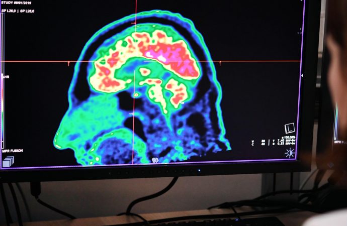 Aggressive Brain Cancer Treatment: Ohio Students’ Research Shows Promise