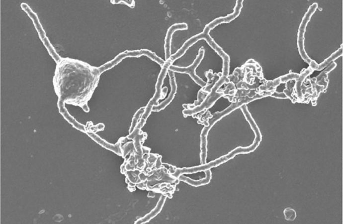 Deep-sea microbe sheds light on primordial evolutionary milestone