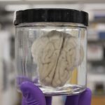 Scientists Brought Brains Brought Back to Life Four Hours After Death