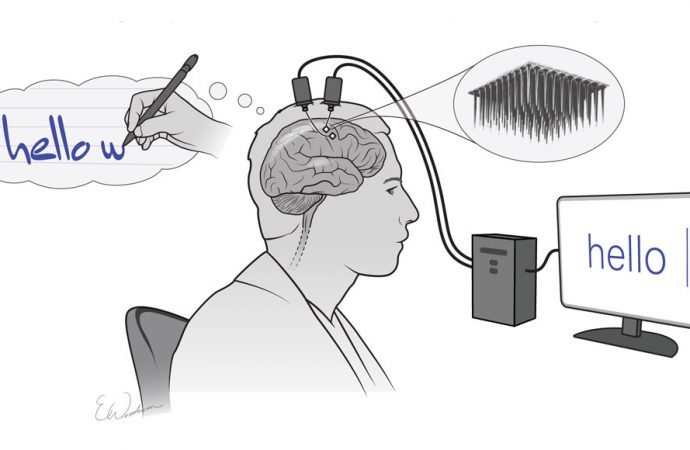 Brain implants turn imagined handwriting into text on a screen