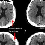 Does life flash before our eyes as we die? A Vancouver man’s brain scan suggests it’s possible